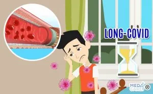 Scopri di più sull'articolo L’endoteliopatia è la causa dei sintomi a lungo termine del Long COVID?