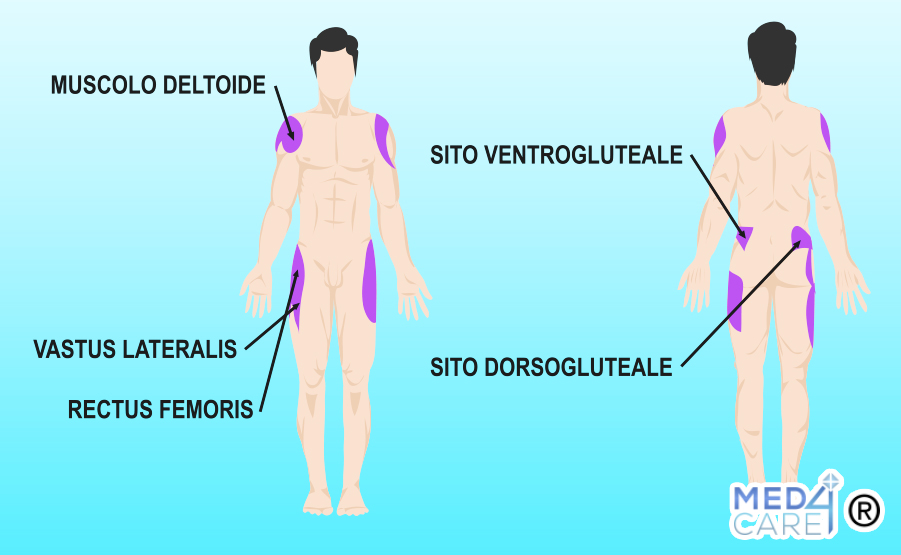 Sedi iniezione intramuscolare