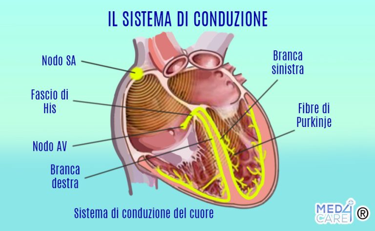 Aritmia sinusale - Med4Care
