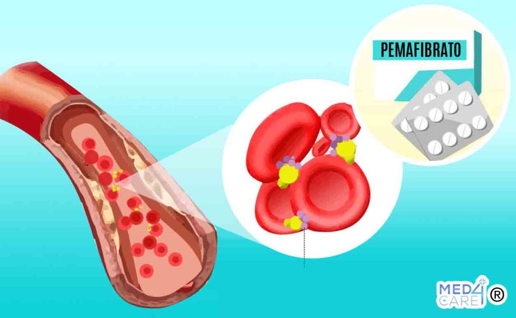 Farmaco pemafibrato e rischio cardiovascolare, trigliceridi