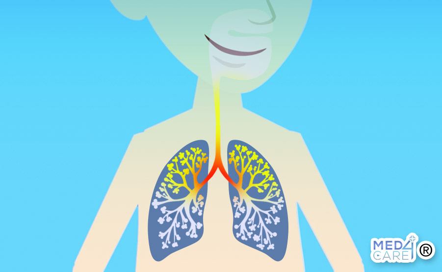 bronchite, pneumologo, pneumologia, malattie respiratorie