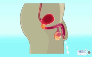 Scopri di più sull'articolo Eiaculazione: come funziona l’uscita dello sperma