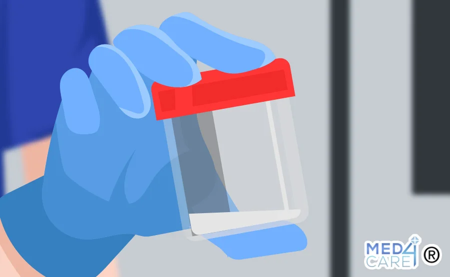 L'esame del liquido seminale