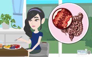 Scopri di più sull'articolo Morbo di Crohn: cosa mangiare?