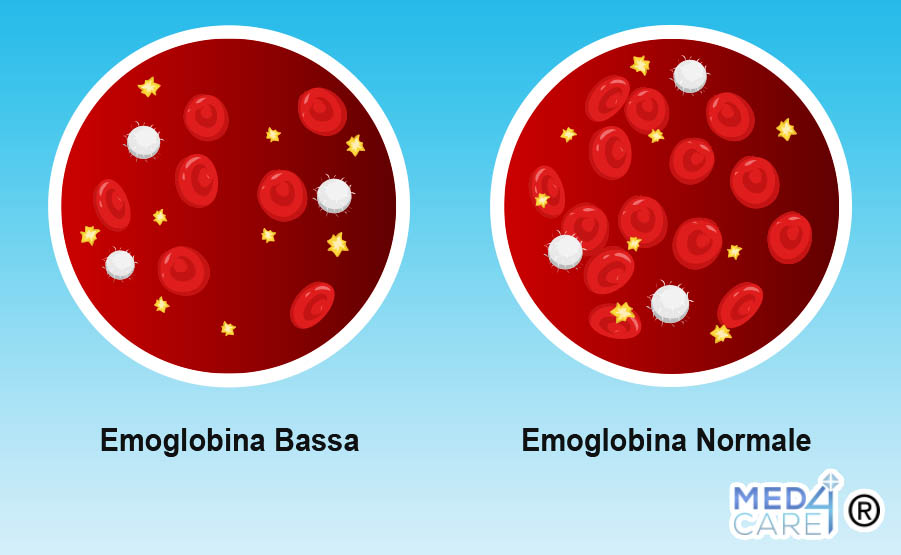 emoglobina bassa, carenza di ferro, emoglobina