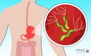 Scopri di più sull'articolo Helicobacter pylori, il batterio più diffuso tra gli esseri umani