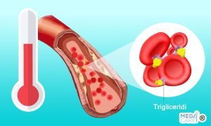 Scopri di più sull'articolo Trigliceridi alti: l’ipertrigliceridemia