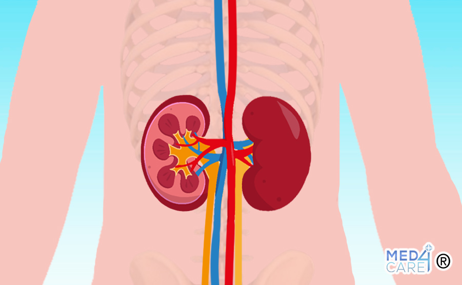 azotemia, reni, tipi di azotemia