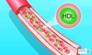 Scopri di più sull'articolo Colesterolo HDL: la parte “buona” del grasso corporeo