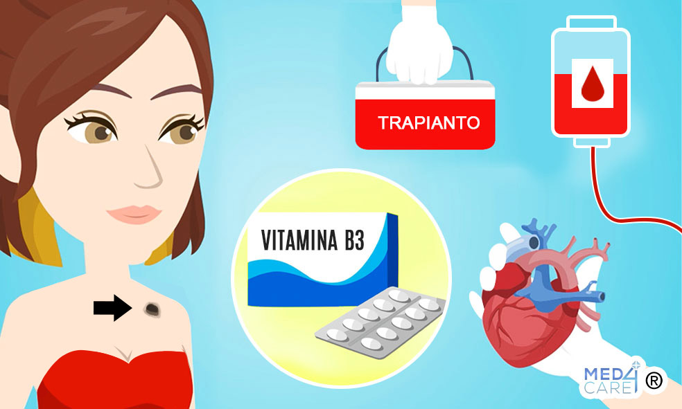 Vitamina B3 riduzione tumore della pelle post trapianto