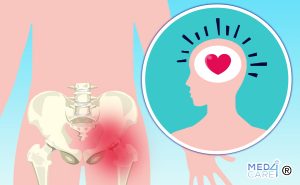 Scopri di più sull'articolo L’artroscopia dell’anca migliora il benessere mentale dei pazienti affetti da conflitto femoro-acetabolare?