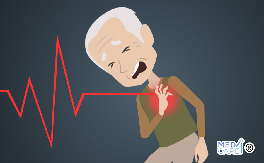 Infarto del miocardio pazienti anziani