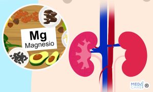 Scopri di più sull'articolo La carenza di magnesio può predire il rischio di mortalità nei pazienti con malattia renale cronica?