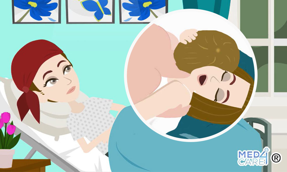 Donne con tumore e disfunzioni sessuali, cancro e problemi sessuali, chemioterapia e problemi sessuali