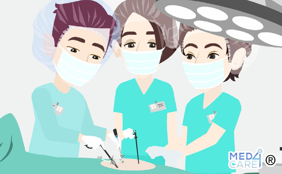 laparoscopia, procedure mediche, chirurgia