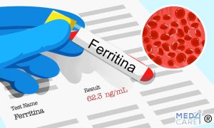 ferritina alta, ferritina, esami di laboratorio, esami del sangue