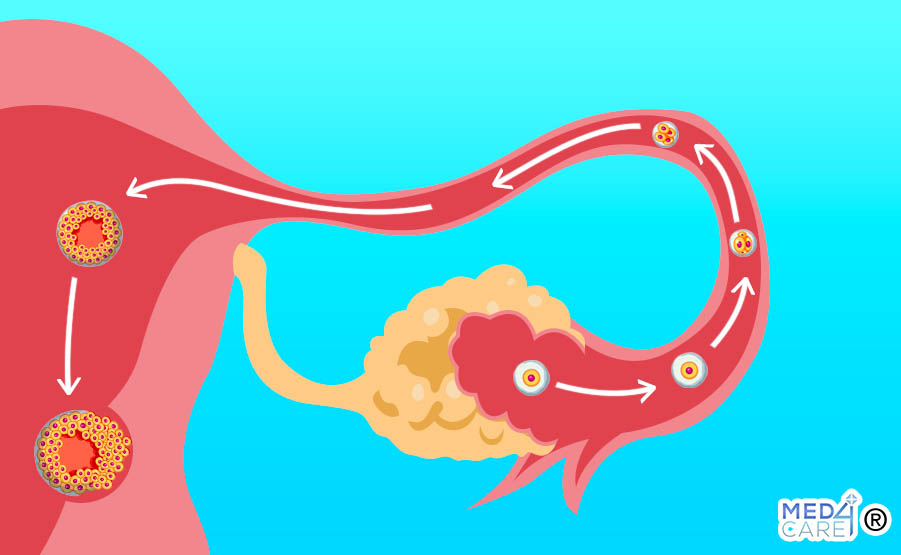 processo di ovulazione, rilascio dell'ovulo