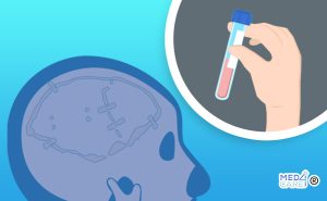 Scopri di più sull'articolo Perdita di liquido cerebrospinale post craniotomia: studio dei fattori di rischio e delle modalità di intervento