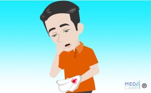 Scopri di più sull'articolo Emottisi: emissione di sangue con la tosse