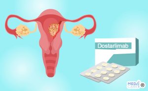Scopri di più sull'articolo Il farmaco biologico Dostarlimab è efficace nella terapia del carcinoma dell’endometrio in stadio avanzato?