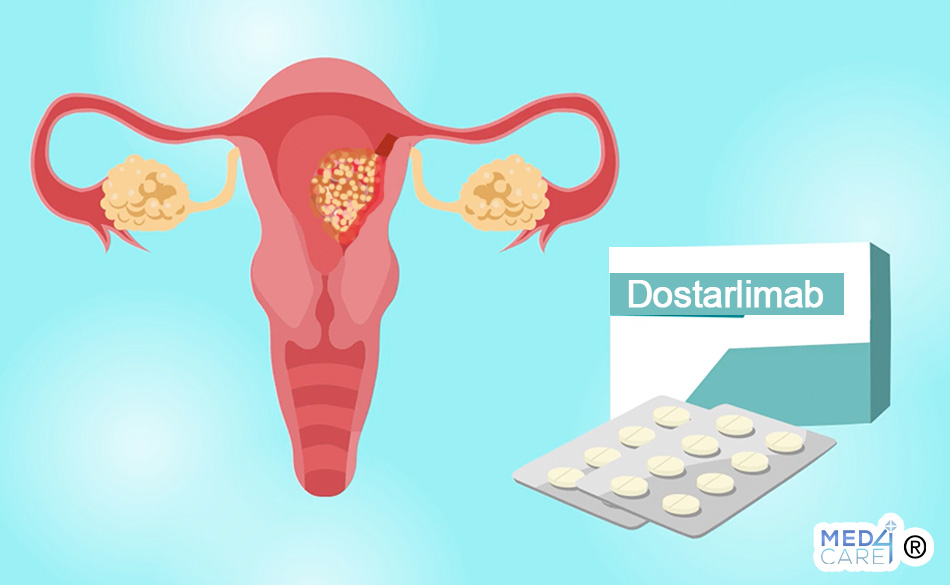 Dostarlimab e carcinoma dell'endometrio, carcinoma dell'endometrio, dostarlimab, cura del carcinoma dell'endometrio