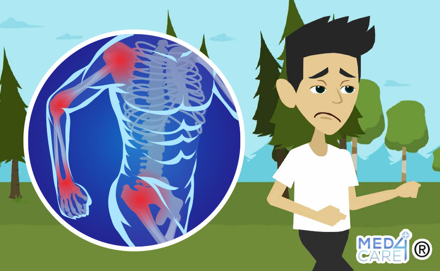 Malattie infiammatorie intestinali e forma fisica