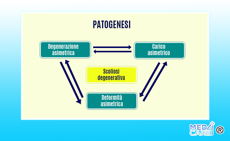 patogenesi della scoliosi, asimmetrie