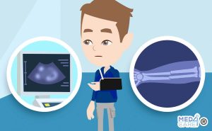 Scopri di più sull'articolo Fratture dell’avambraccio nel bambino: per la diagnosi è più efficace la radiografia o l’ecografia?