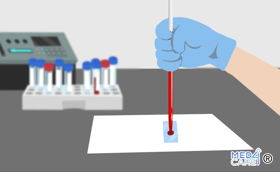 Biopsia