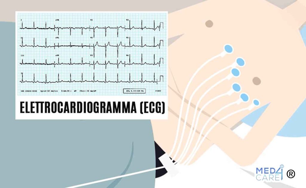 ECG e colesterolo
