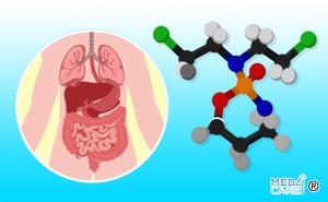 Scopri di più sull'articolo La ciclofosfamide può fare la differenza nella profilassi della GvHD (Malattia del trapianto contro l’ospite)?