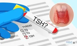 Scopri di più sull'articolo TSH