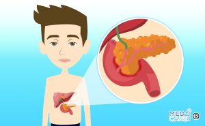 Scopri di più sull'articolo Cancro epato-bilio-pancreatico