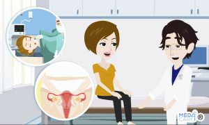Fibroma uterino e tecniche chirurgiche, fibroma, mioma