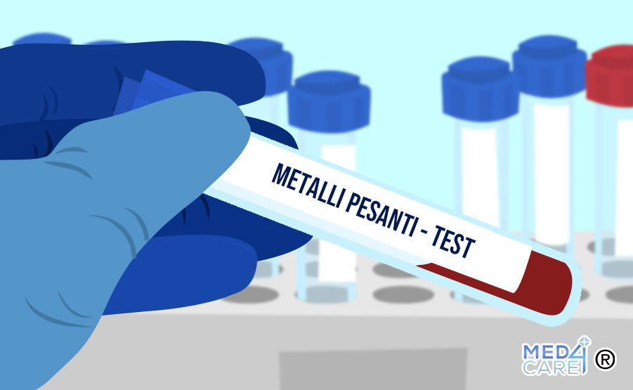 intossicazione da metalli pesanti