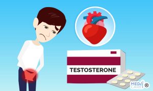 Testosterone per ipogonadismo e rischi vascolari, ipogonadismo, testosterone