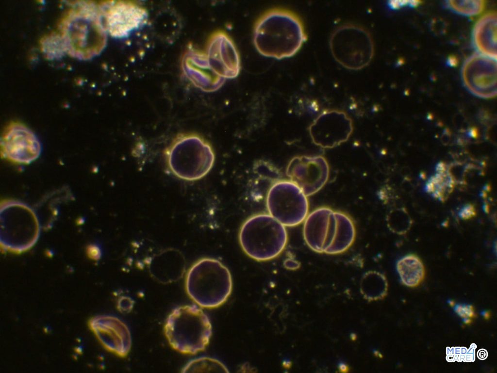 Microscopia in campo oscuro