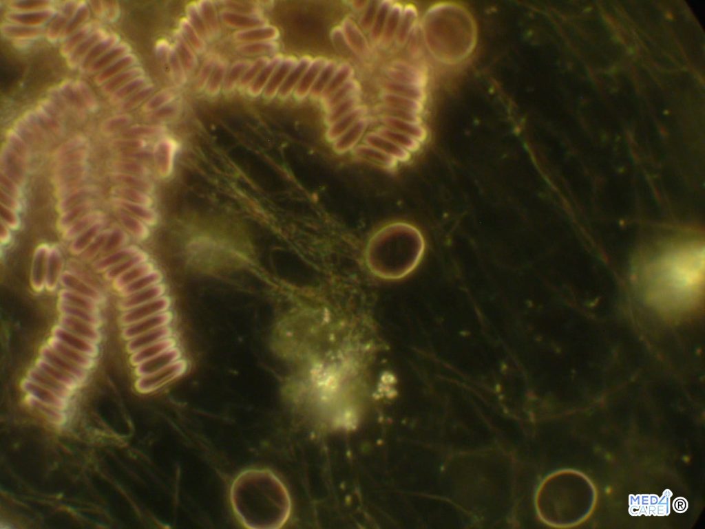 Microscopia in campo oscuro