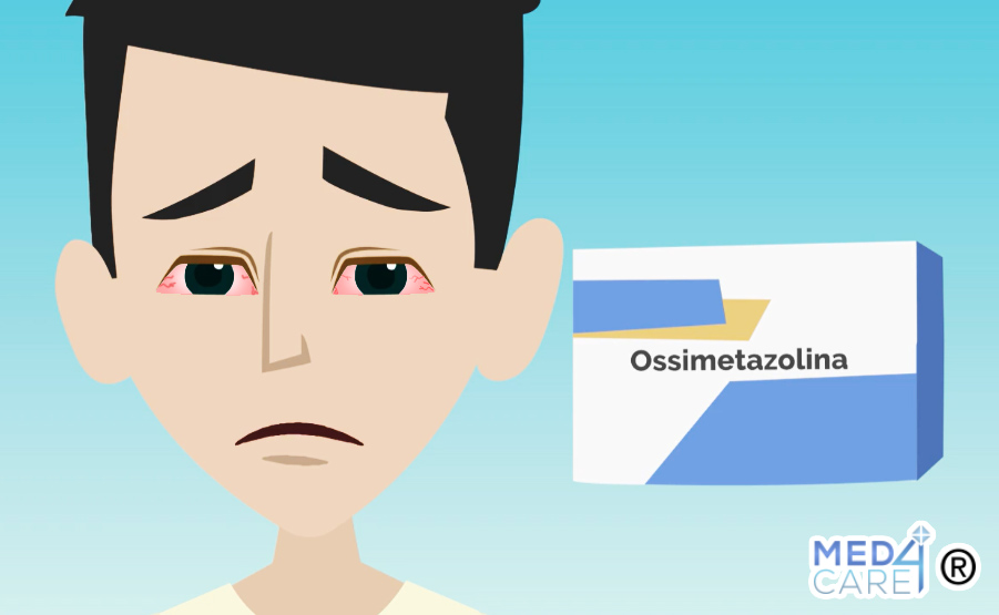 Ossimetazolina e salute dell'occhio, ossimetazolina, occhi rossi