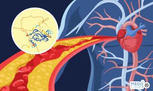 Scopri di più sull'articolo Il ruolo immunitario del fattore Tbx1 nel processo di guarigione dell’infarto del miocardio