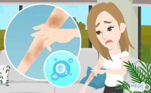 Scopri di più sull'articolo Efficacia dell’ozonoterapia nel trattamento delle malattie cutanee