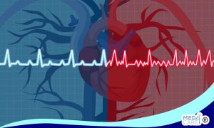 Scopri di più sull'articolo L’ablazione transcatetere può prolungare la vita dei pazienti affetti da insufficienza cardiaca grave con fibrillazione atriale?
