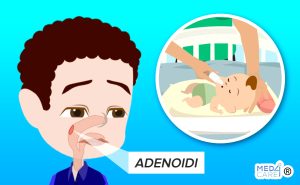 Scopri di più sull'articolo Prevenzione delle adenoidi ingrossate: l’importanza dei lavaggi nasali