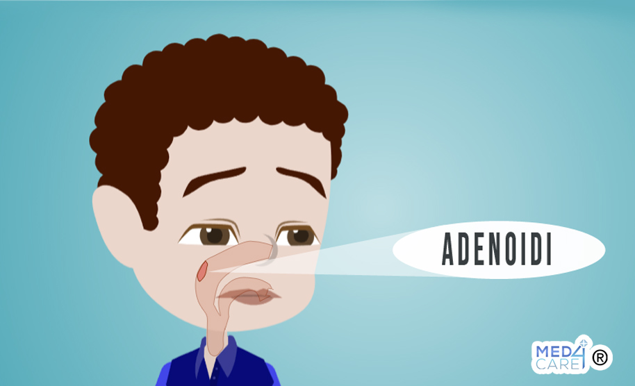 adenoidi, anatomia delle adenoidi