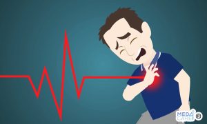 Scopri di più sull'articolo Infarto del miocardio