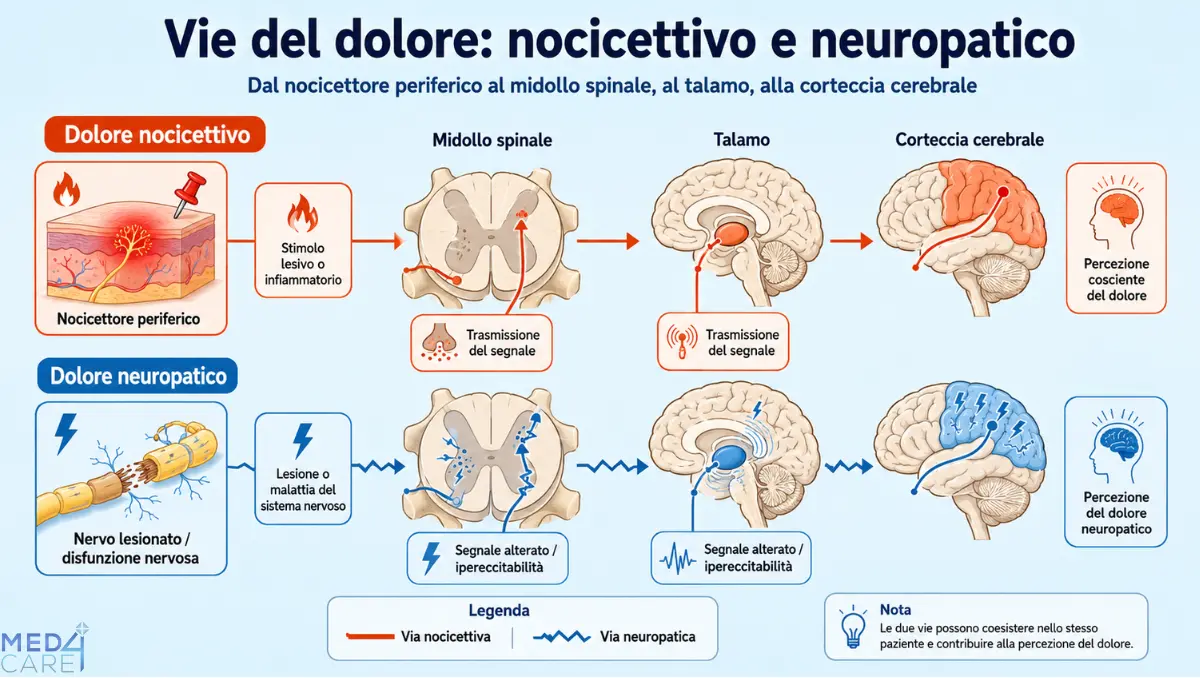 Schema delle vie del dolore nocicettivo e neuropatico dal nocicettore periferico al midollo spinale al talamo alla corteccia cerebrale». Non serve modificarlo.